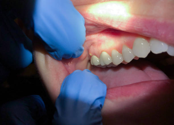 Best Orthodontic Emergency Dentist in West Conshohocken, PA
