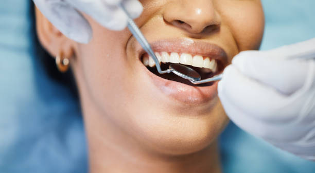 Best Emergency Dentist for Lost Fillings or Crowns in West Conshohocken, PA