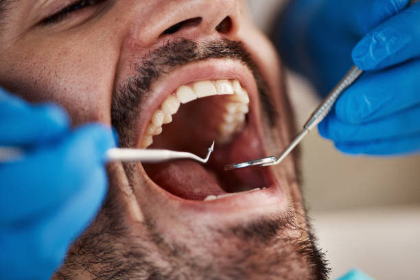 Best Emergency Dentist for Knocked-Out Tooth in West Conshohocken, PA